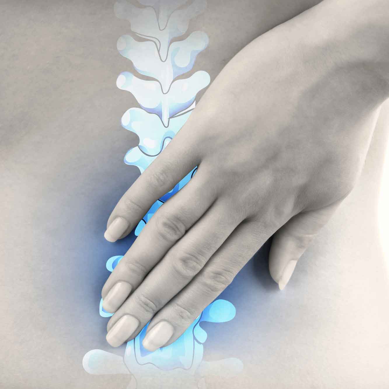Acute-sciatica