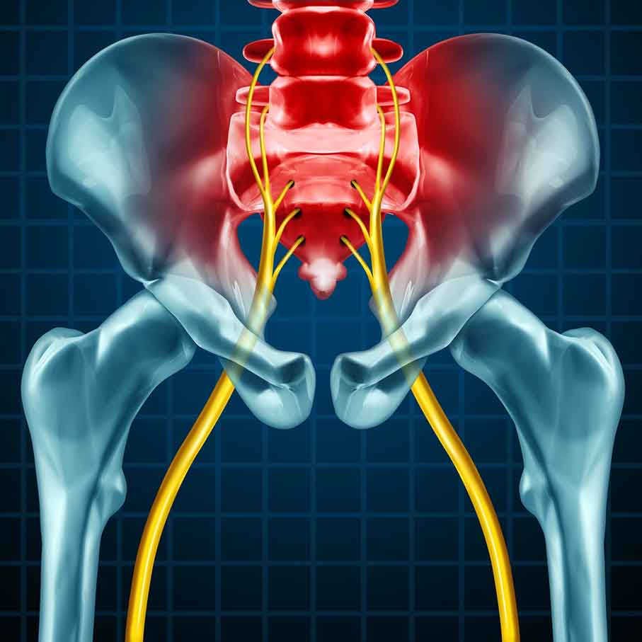 Are-you-suffering-from-sciatica