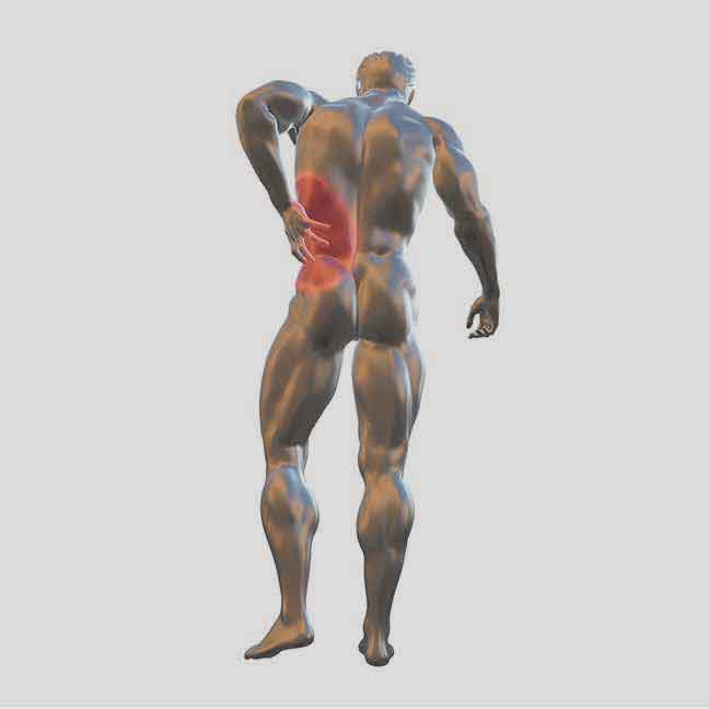 Bilateral-sciatica