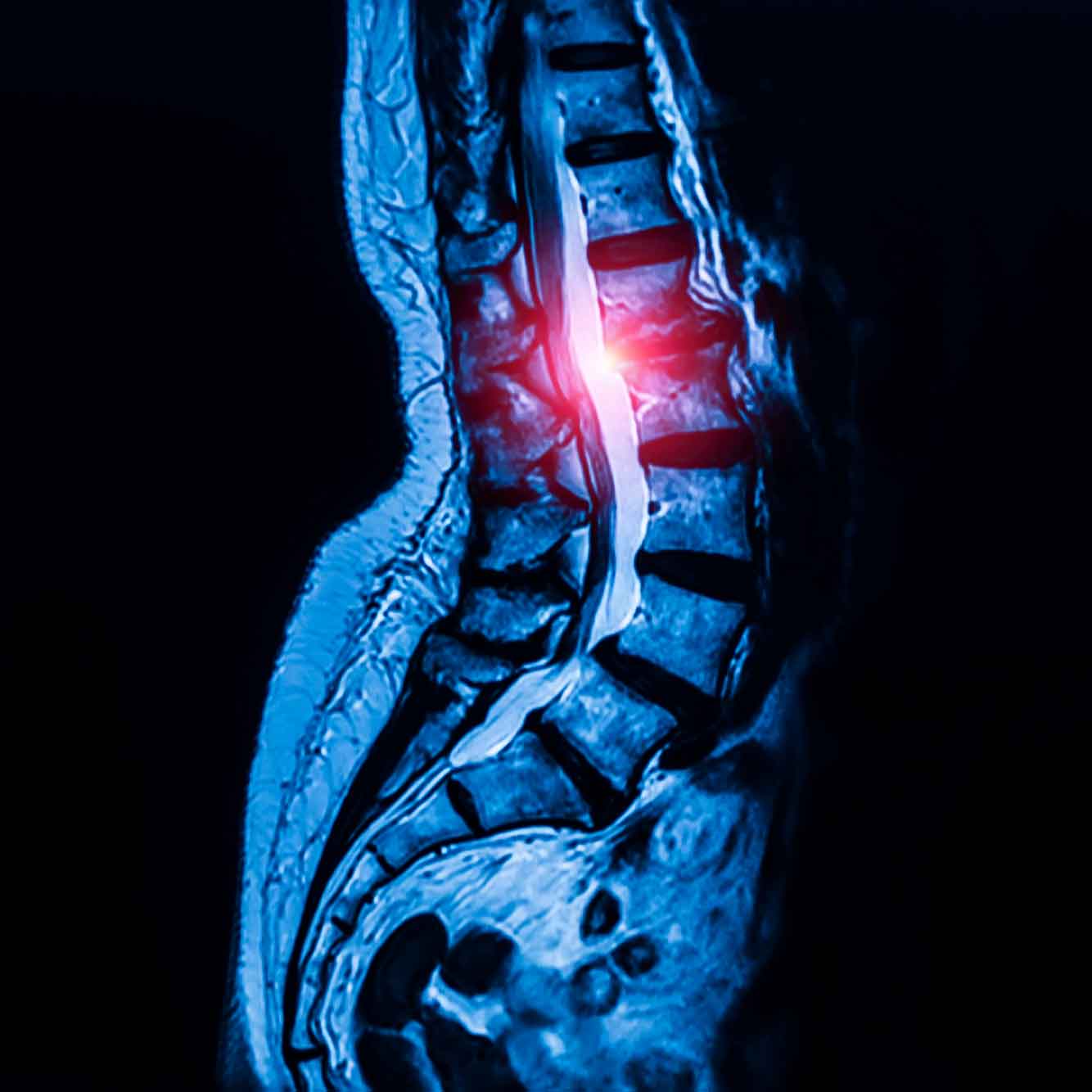 Pain-in-shoulder-blades-upper-or-middle-back