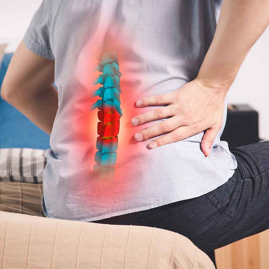 Sciatica