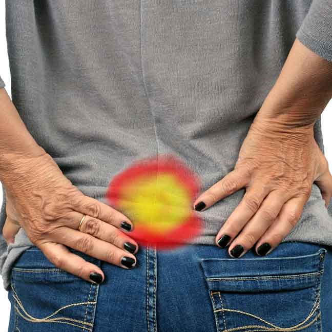Sciatica