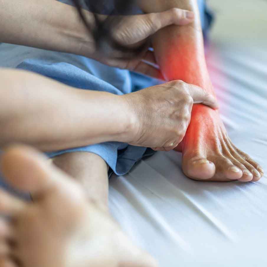 Tarsal-tunnel-syndrome