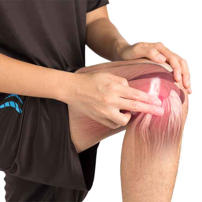 Traumatic-injury-involving-connective-tissue