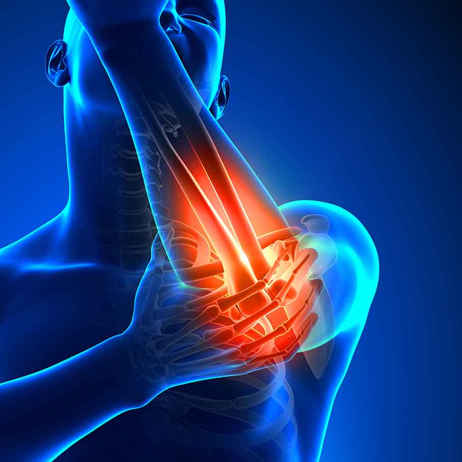 arthritis-pain