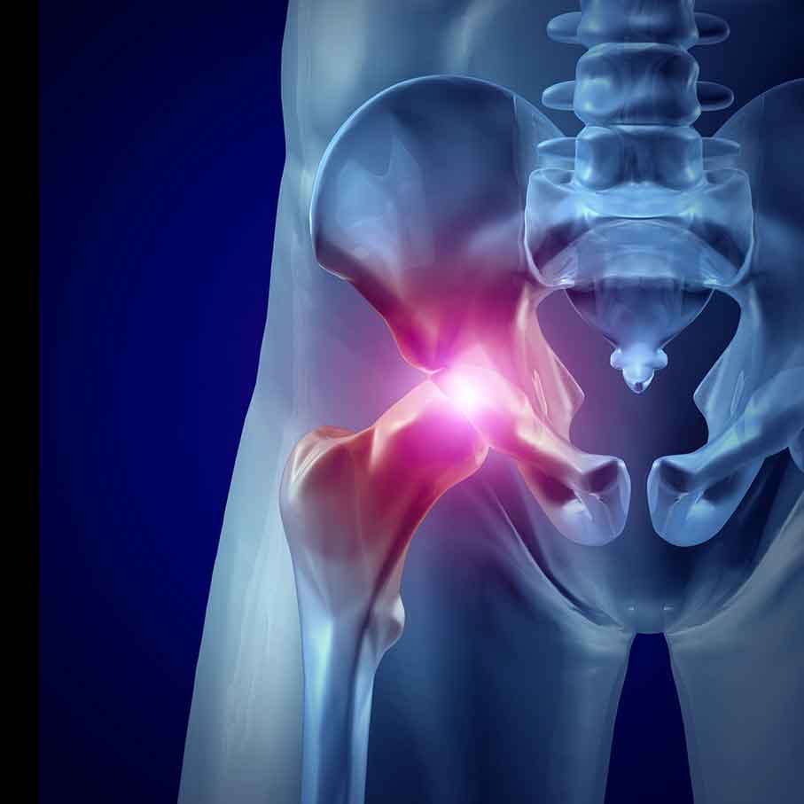 pain-in-your-hips