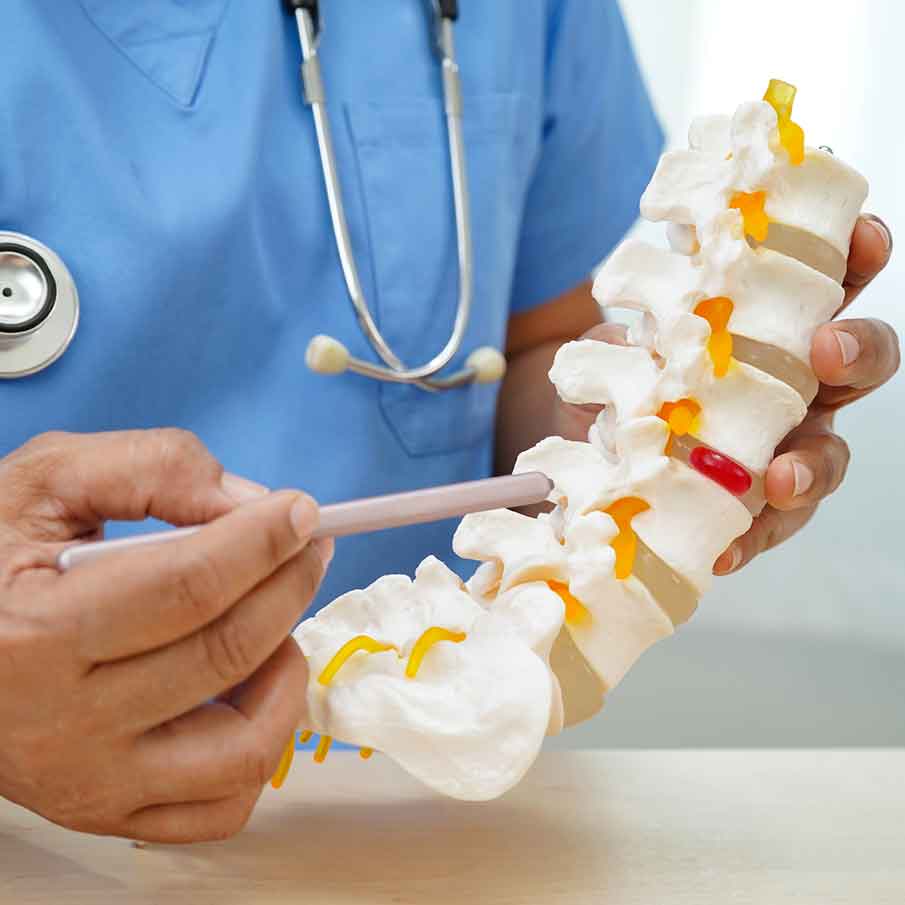 pinched-nerves-caused-by-degenerative-disc-disease