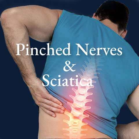 Pinched-nerves-sciatica