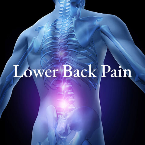 Lower-back-pain