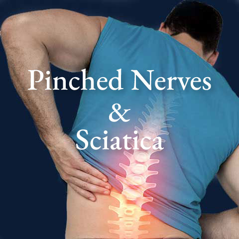 Pinched-nerves-sciatica.