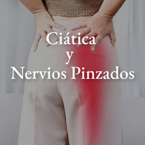 Ciática-nervios-pinzados