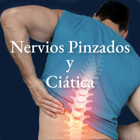 nervios-pinzados-ciática